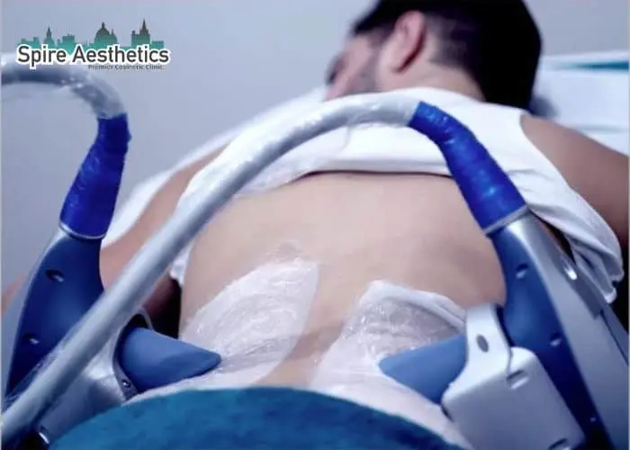 Man having fat freezing treatment done on love handles before a competitions Hayes to create a sculpted look.