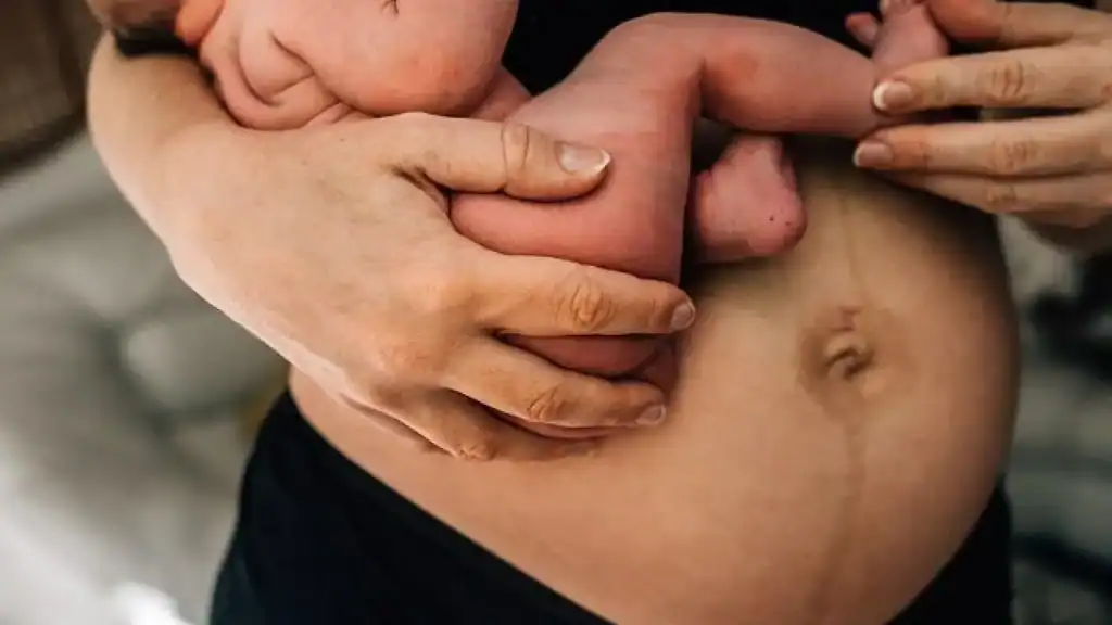 Why Is My Stomach Still Big After Pregnancy Hayes?