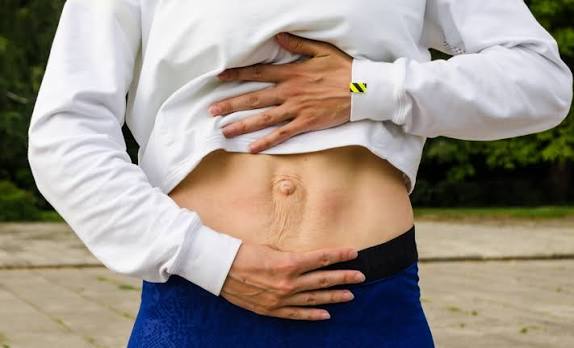 When Could Diastasis Recti Be the Missing Piece of the Puzzle Hayes?